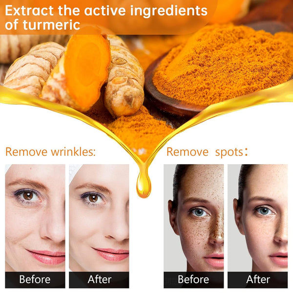 Glow-Boost Turmeric Serum